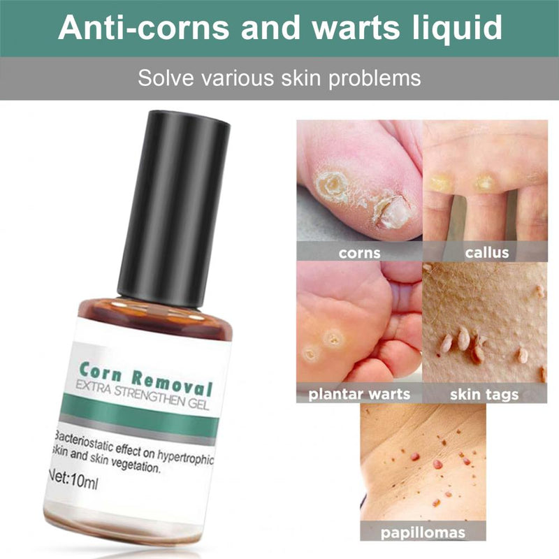 10ML Useful Corn Removal Treatment Natural Compact Easy to Use Wart Remover Extra Strengthen Gel for Personal External Use personal care  beauty cosmetic & personal care