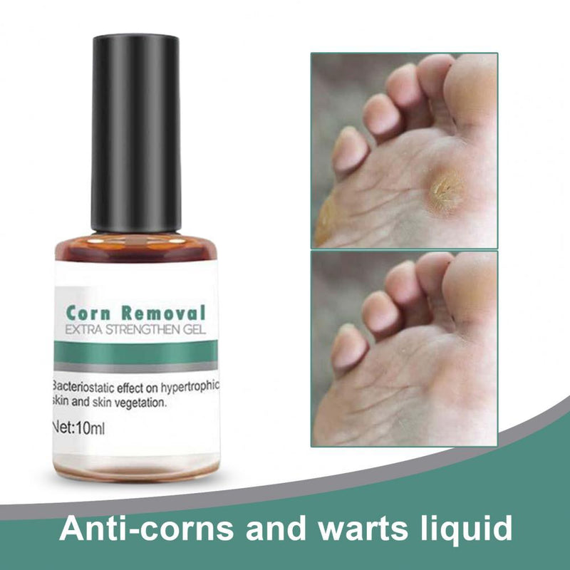 10ML Useful Corn Removal Treatment Natural Compact Easy to Use Wart Remover Extra Strengthen Gel for Personal External Use personal care  beauty cosmetic & personal care