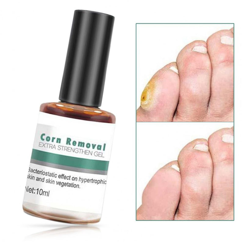 10ML Useful Corn Removal Treatment Natural Compact Easy to Use Wart Remover Extra Strengthen Gel for Personal External Use personal care  beauty cosmetic & personal care