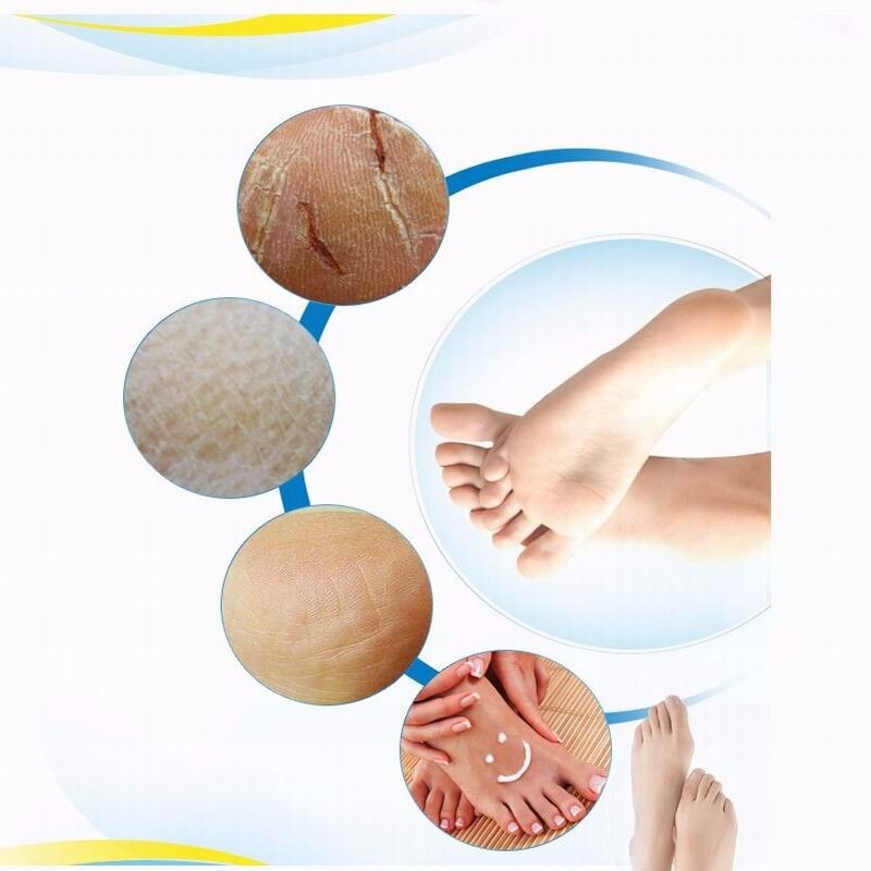 Health Professional Beauty Cracked Heel Unisex Moisturizing Natural Foot Repair Oil Foot Care Cream personal care  beauty cosmetic & personal care